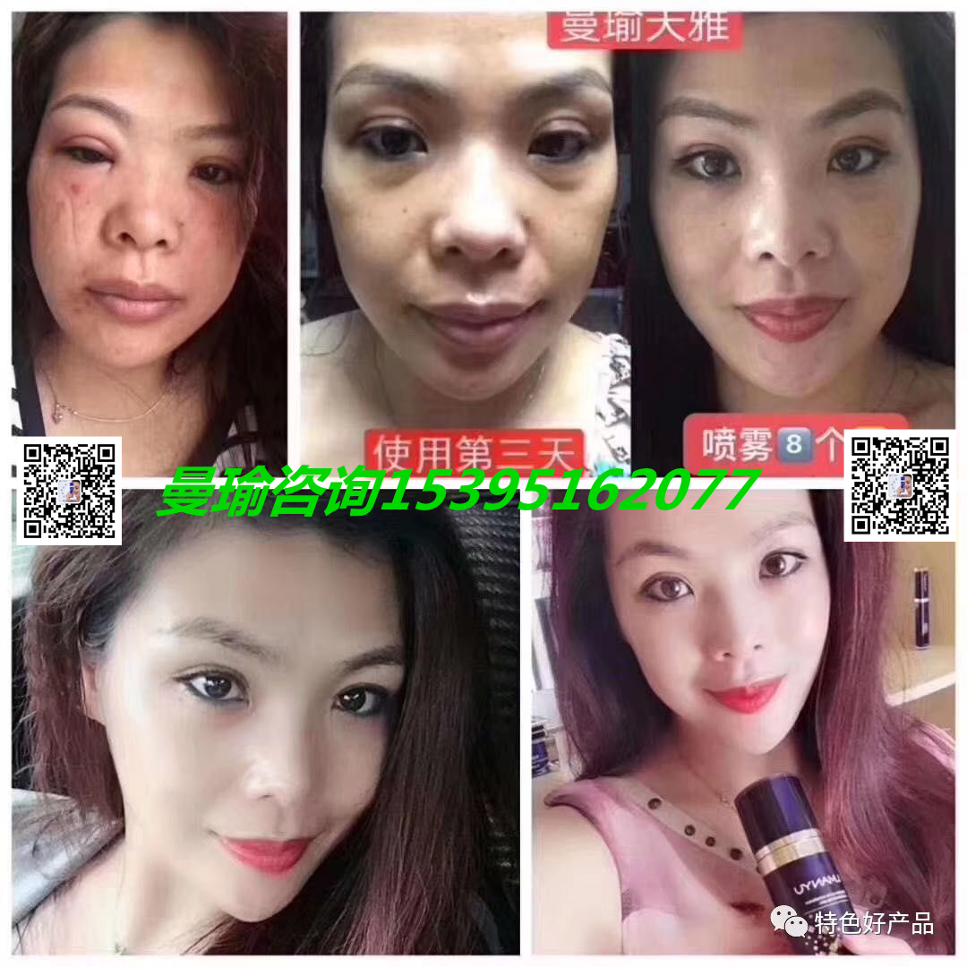 脸上长痘痘用什么护肤品？曼瑜天雅官网旗舰店