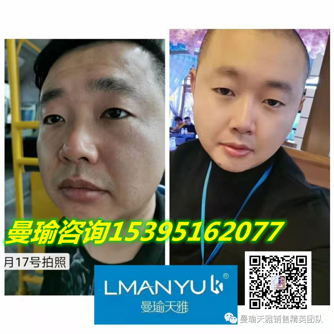 脸上长痘痘用什么护肤品？曼瑜天雅官网旗舰店