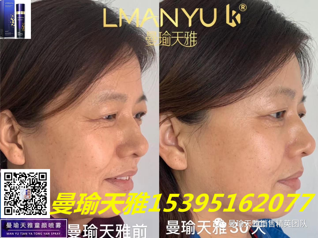 皮肤瘙痒 皮肤痘痘，用什么护肤品？曼瑜天雅童颜喷雾效果好
