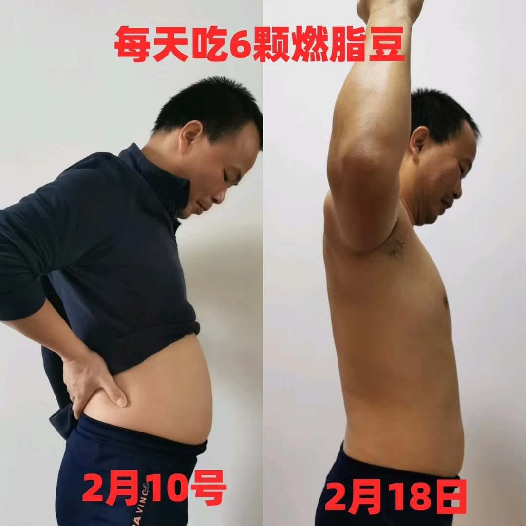 顽固体质吃无限畅燃脂豆压片糖果有效吗？高级代理多少钱？