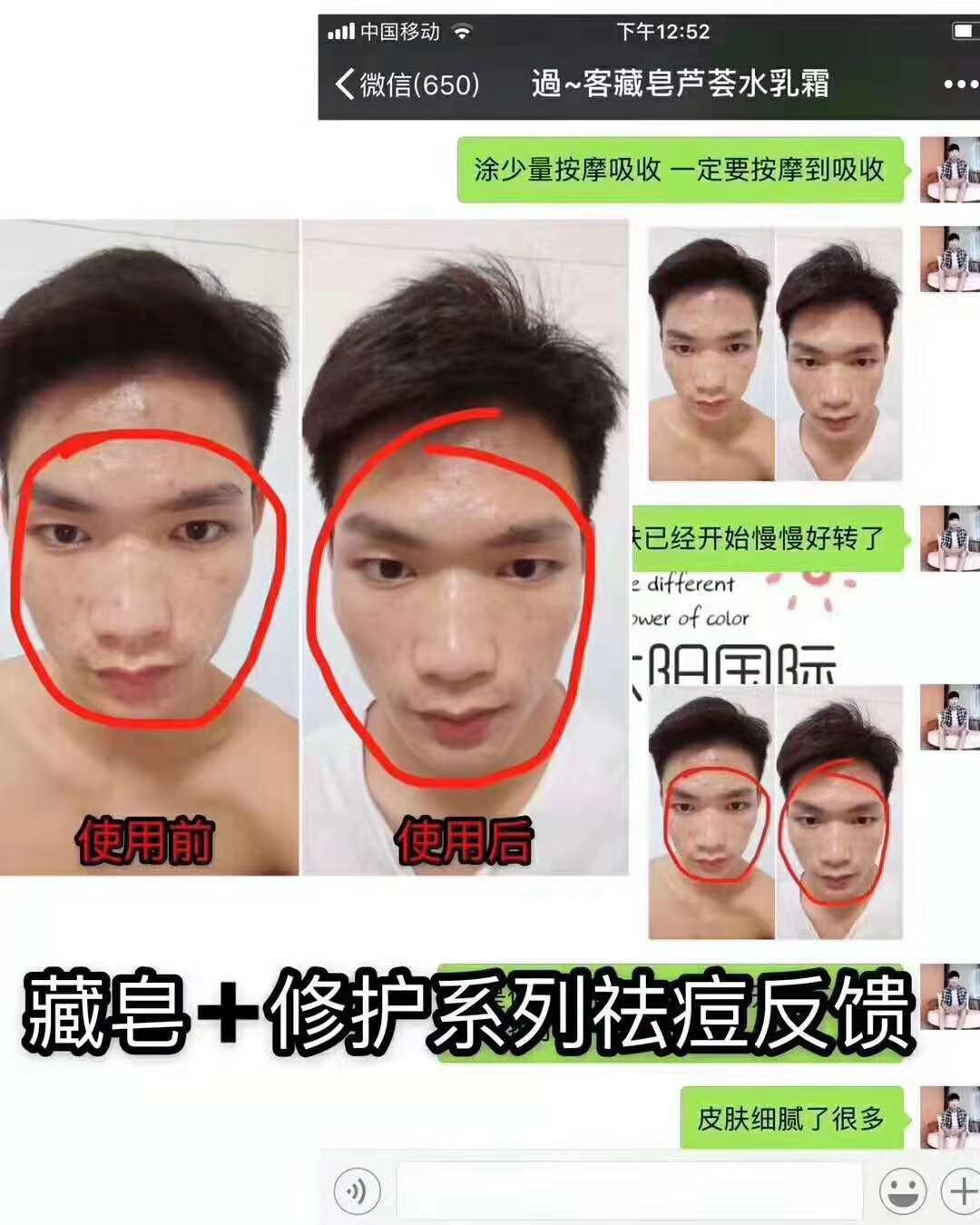 朵色正品喜藏多少钱一块？祛痘效果好不好？