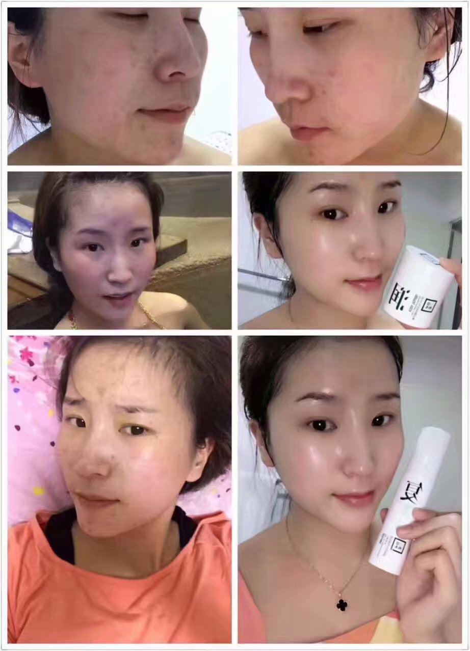 三草两木健康水真的能祛痘?一瓶能用多久?价位是多少？