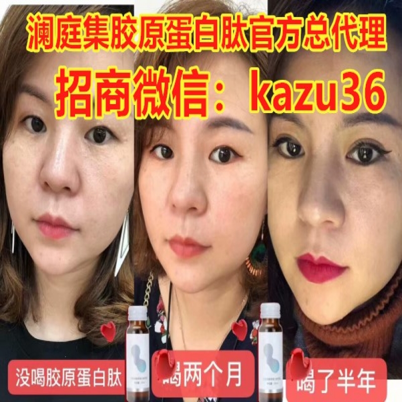 --澜庭集胶原蛋白肽有效果吗？一箱多少钱